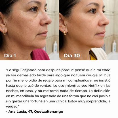 Escultor Facial LED 7 en 1 Lux Cove®