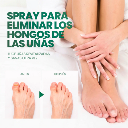 La fórmula en spray que atraviesa la uña y elimina el hongo desde la raíz